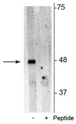Western Blot: p62/SQSTM1 [p Ser28] Antibody [NBP2-60272] - Analysis of Jurkat cell lysate showing specific immunolabeling of the 48 kDa p62 phosphorylated at Ser28 in the first lane (-). Phosphospecificity is shown in the second lane (+) where immunolabeling is blocked by preadsorption of the phosphopeptide used as antigen, but not by the corresponding non-phosphopeptide (not shown).